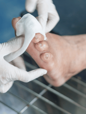 Infection Control