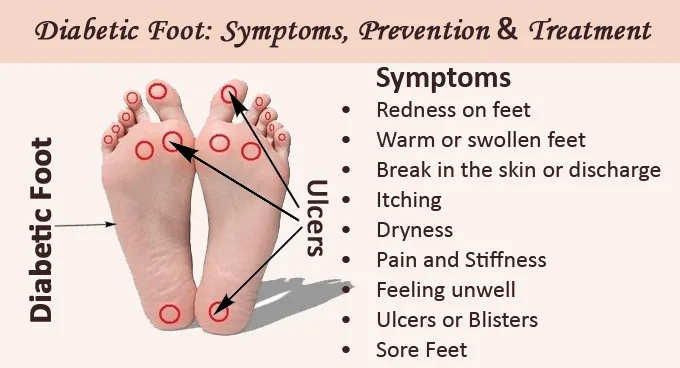 Prevention, Symptoms & Treatment