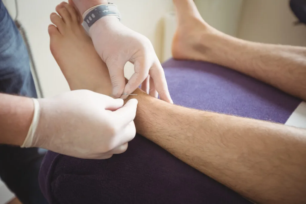 Diagnosis of Diabetic Foot Ulcer in Nursing