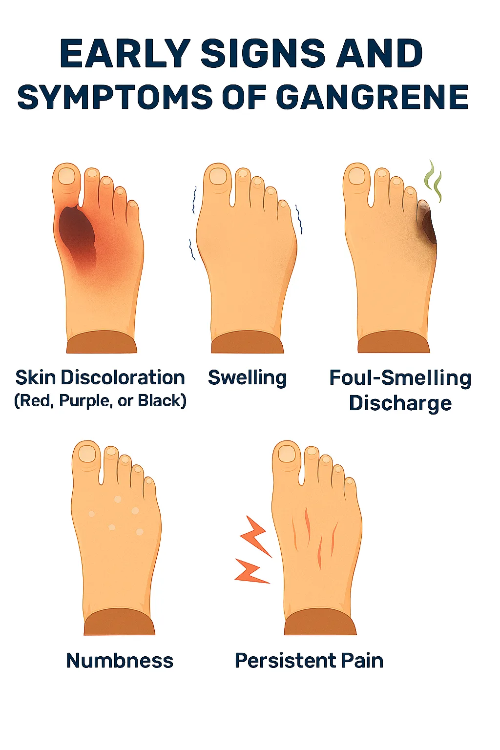 Early Signs and Symptoms of Gangrene