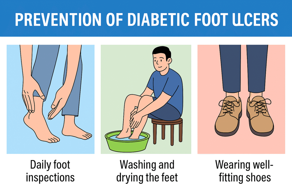 Prevention of Diabetic Foot Ulcers