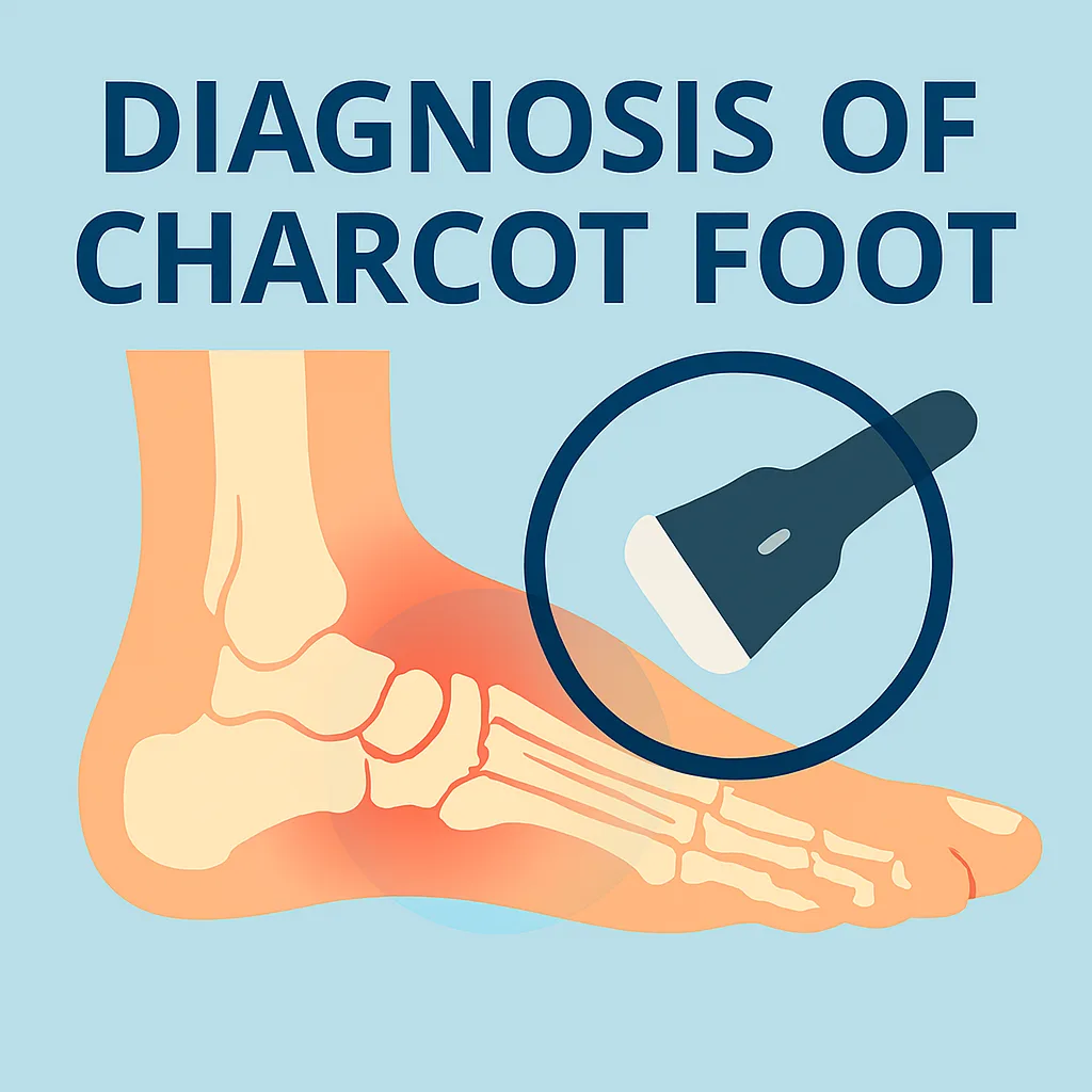 Diagnosis of Charcot Foot