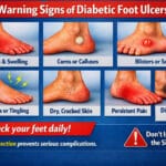 Warning Signs: Identifying Diabetic Foot Ulcers Before They Start