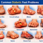 diabetic foot problems